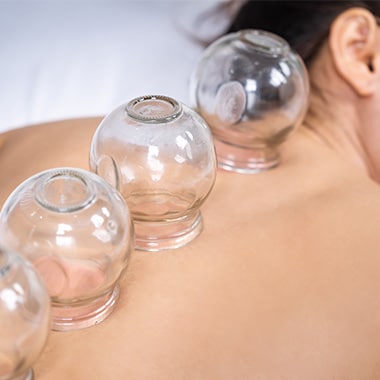 Patient receiving cupping therapy treatment at Chiropractic Center of Longmont