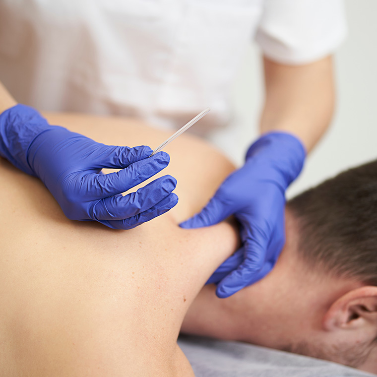 Dry Needling- What to Look for in a Qualified Practitioner